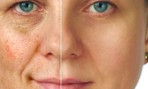 1 masca de fata care albeste tenul cum se prepara wwsx jpg jpeg