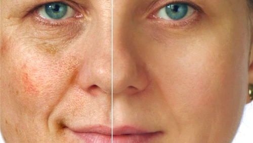 1 masca de fata care albeste tenul cum se prepara wwsx jpg jpeg