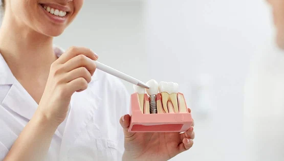 implant jpg