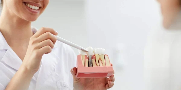 implant jpg