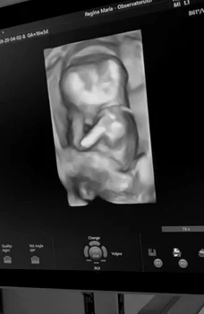 1 alina ceusan e insarcinata 7 jpg jpeg