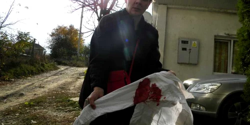 Cămaşa de şcoală a fetiţei este plină de sânge