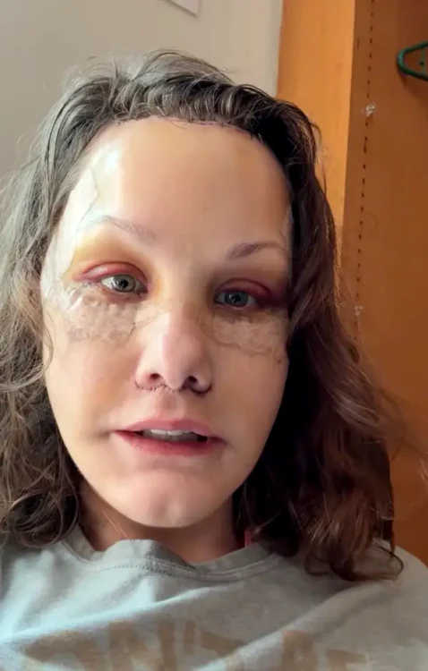 Transformarea unei femei i-a lăsat pe internauți cu gura căscată: „I-a șters 20 de ani!” Ea a apelat la lifting facial în Mexic 2 FOTO Michelle Wood