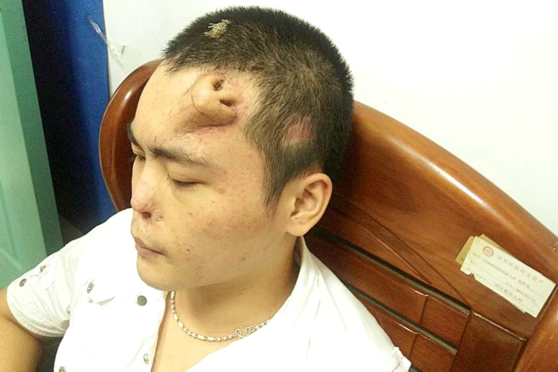 Xiao Wei, înainte de operaţie (Fotografii: Reuters)