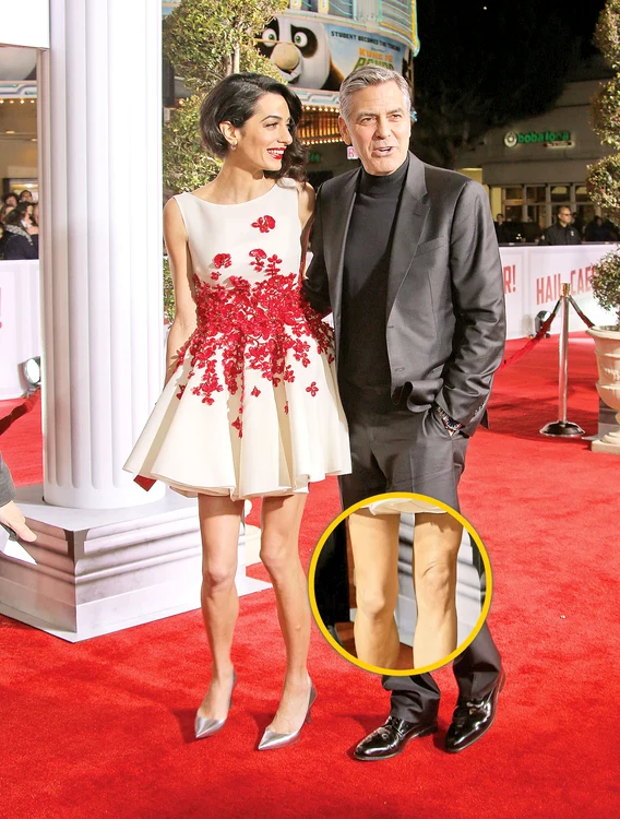 Amal a şocat pe toată lumea, cu  picioarele subţiri şi zbârcite,  când şi-a însoţit soţul la teatru