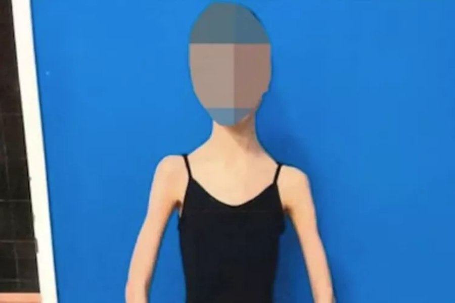 Motivul halucinant pentru care o balerină a fost înfometată de părinți: „La 17 ani cântărea doar 28 de kilograme”