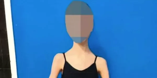 ballerina malnourished perth 013125 4 08305e08a850435d9edb0bc0df6b5598 webp