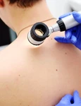 1 dermatoscop jpg jpeg