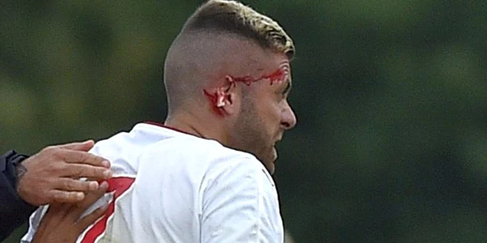 
    Jeremy Menez a fost călcat cu crampoanele pe cap de un jucător african al lui LorientFoto Click!  