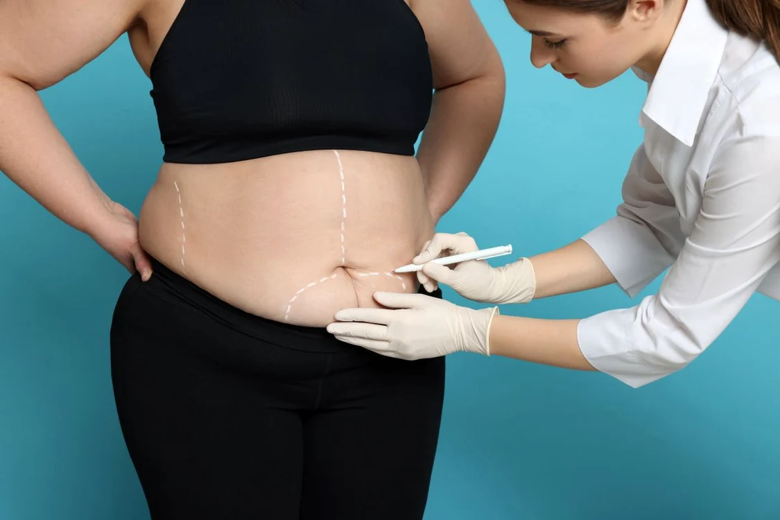 Operația de micșorare a stomacului trebuie urmată de regim alimentar Foto: Shutterstock
