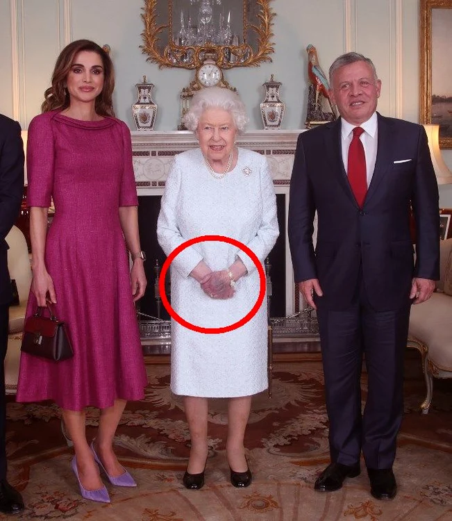 Pe mâna stângă a Reginei Elisabeta este o vânătaie uriașă