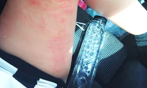 Solista s a rănit la ambele picioare în timpul celor 12 ore de filmări jpeg