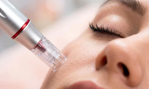 dermapen jpg