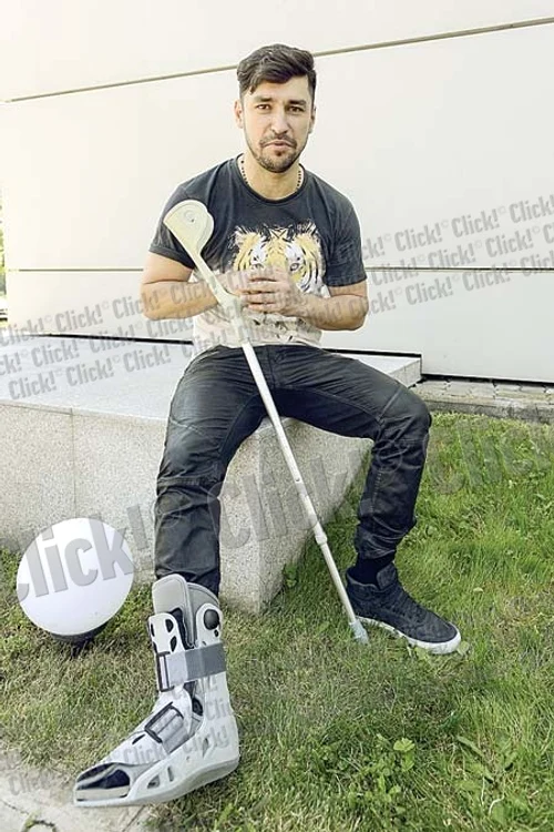 Solistul de la Deepcentral trebuie să poarte orteza trei săptămâni (FOTO: ARHIVA PERSONALĂ)