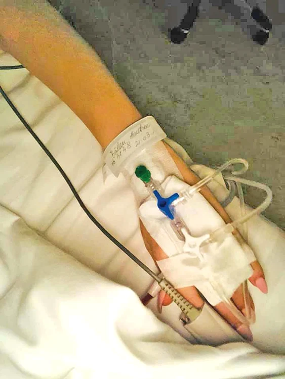 
    Lui Florin Busuioc i s-a  montat cel de-al doilea  stent, după infarctul de la  sfârşitul anului trecut  