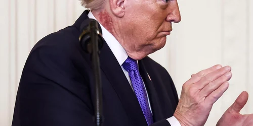 Donald Trump, cu o pată roșie pe gât FOTO Profimedia