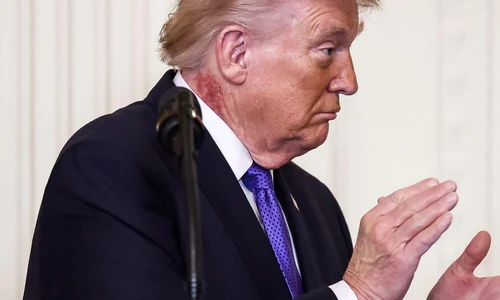 Donald Trump, cu o pată roșie pe gât FOTO Profimedia