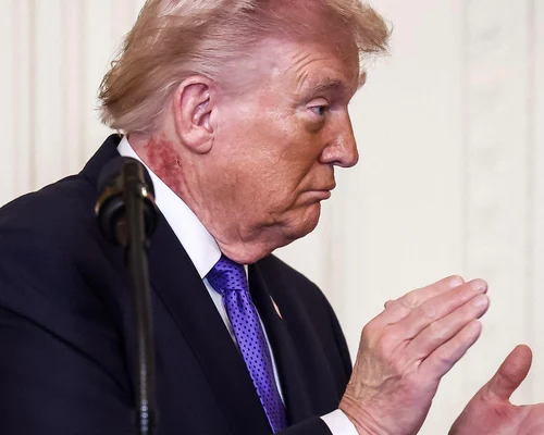 Donald Trump, cu o pată roșie pe gât FOTO Profimedia