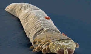Așa arată un acarian Demodex jpeg