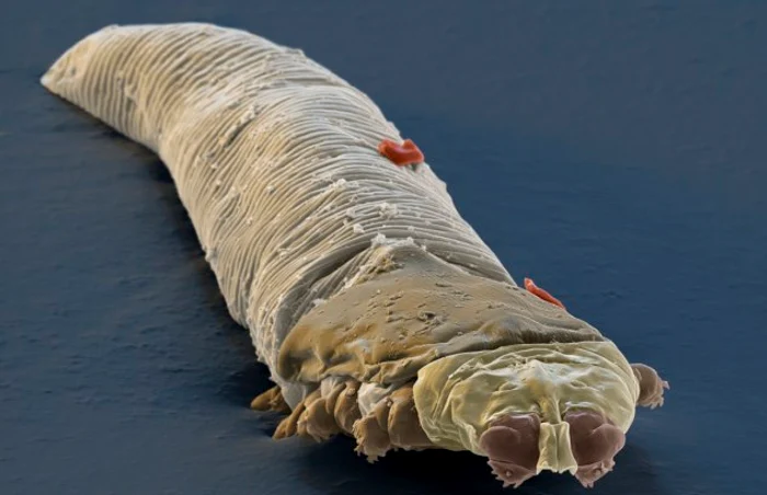 Așa arată un acarian Demodex