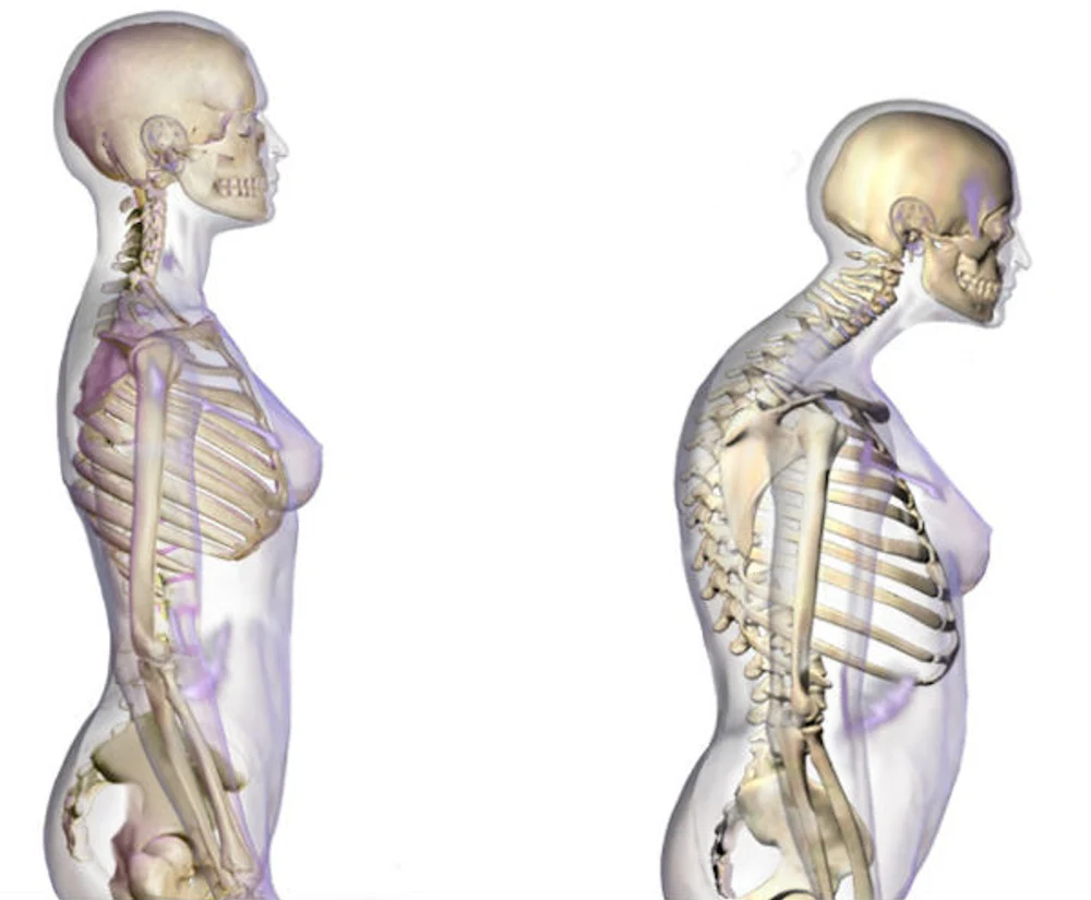 La ce vârstă începem să devenim mai scunzi. Cu cât ne micșorăm anual și cum putem încetini declinul masei osoase