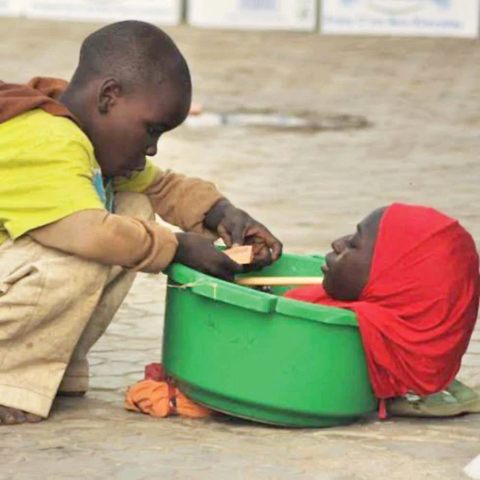 
    Rahama Haruna suferă  de o maladie rară pe care  medicii nu o pot explica  