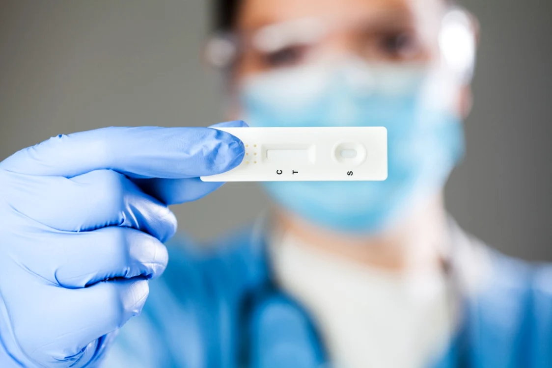 Potrivit lui Voiculescu, farmaciile vor primi gratuit, prin intermediul direcţiilor de sănătate publică, kit-uri de testare, costul urmând să fie stabilit de acestea Foto: Arhivă