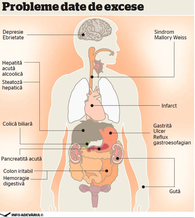 infografie