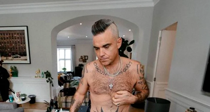 Robbie Williams e disperat să-și refacăpodoaba capilarăFoto: Instagram