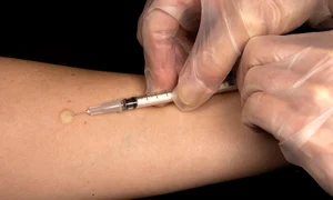 1 vaccination 67477 960 720 jpg jpeg