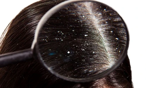 1 83561 original jpg jpeg