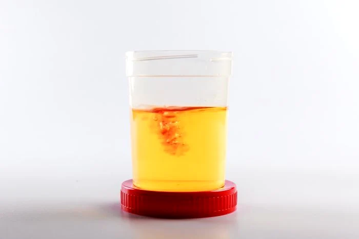 1 sange urina jpg jpeg