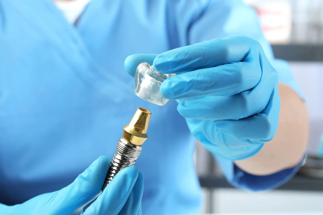 Ce include pretul unui implant dentar complet  De la consultatie la control final jpg