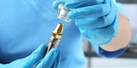 Ce include pretul unui implant dentar complet  De la consultatie la control final jpg