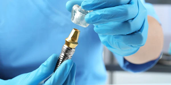 Ce include pretul unui implant dentar complet  De la consultatie la control final jpg