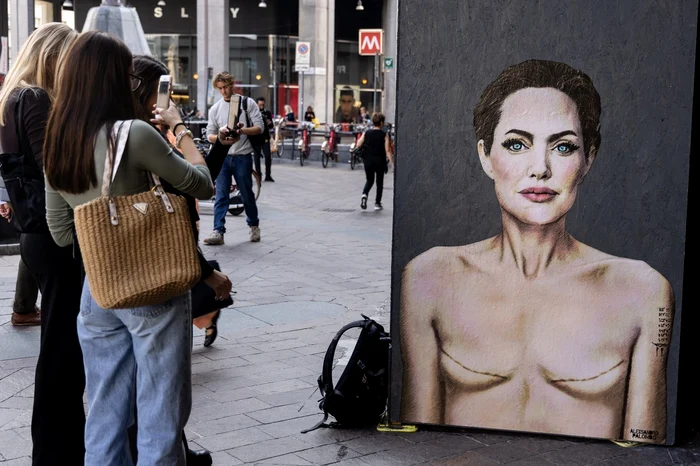 Imagine socanta cu Angelina Jolie si semnele mastectomiei Profimedia (2) jpg
