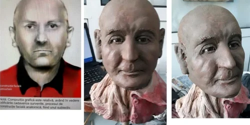 reconstructie faciala