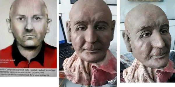 reconstructie faciala