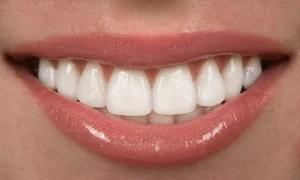 1 cum sa ai dinti sanatosi si frumosi fara sa mergi la dentist 11n3 jpg jpeg