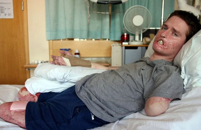 
    Alex Lewis (foto: Rexfeatures)  