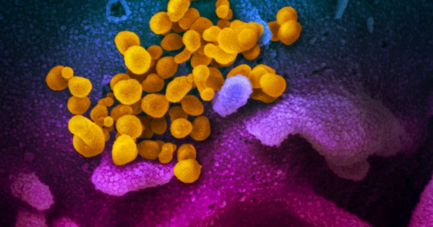 Coronavirus la microscop Foto via NIAID-RML