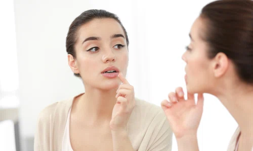 herpes bucal jpg