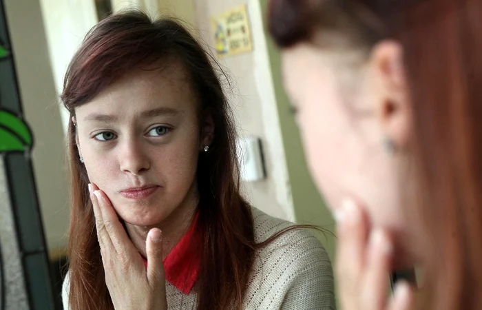 Emma şi Stacy nu pot ieşi din casă fără cremă (Foto: Photoland/Caters)