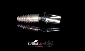 poza implant a implant cu bont jpeg