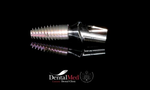 poza implant a implant cu bont jpeg