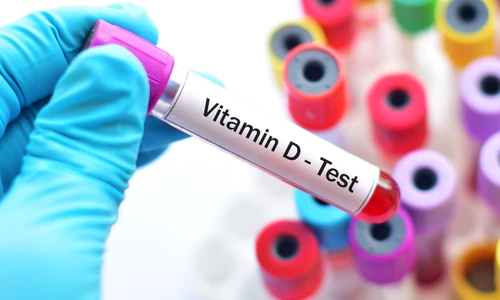 shutterstock 730877215 jpg