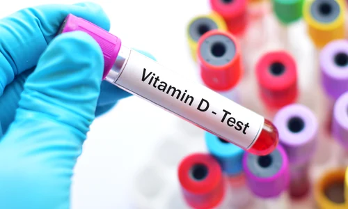 shutterstock 730877215 jpg