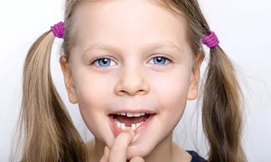 dinti24 g foto4 85 70 shutterstock 573828220 jpeg