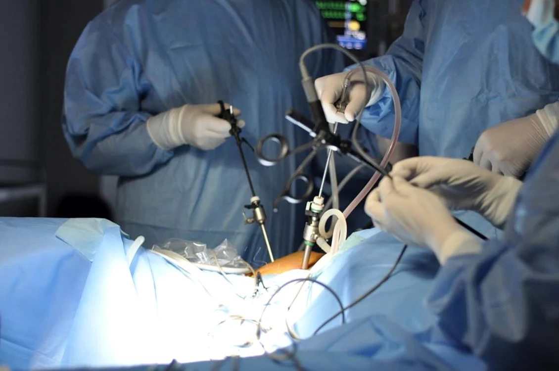 Endometrioza este o afecţiune ginecologică extrem de dureroasă