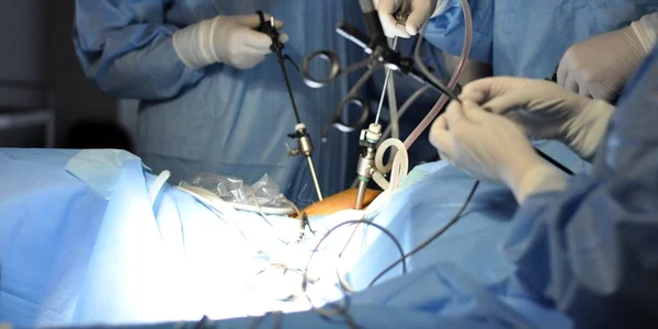 Operatie endometrioza